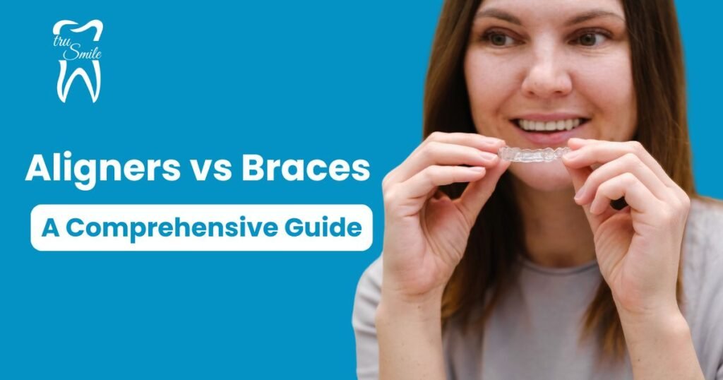 Image with a blue background showing a person holding a clear aligner. Text reads 'Aligners vs Braces: A Comprehensive Guide' with a tooth logo and 'tru Smile'.