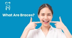 A person in a white shirt points to their mouth with both hands. The text 'What Are Braces?' and a logo with the words 'tru Smile' are displayed on a blue background.