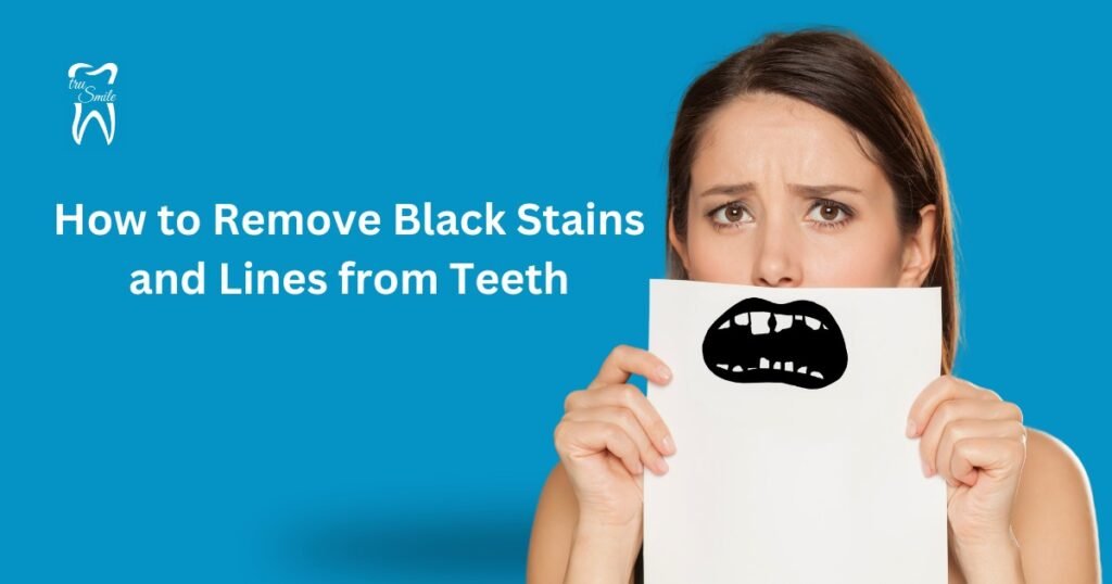 A person holds a white paper with a black stain in front of a blue background. The text reads: "How to Remove Black Stains and Lines from Teeth" with a logo of a tooth and the words tru Smile.