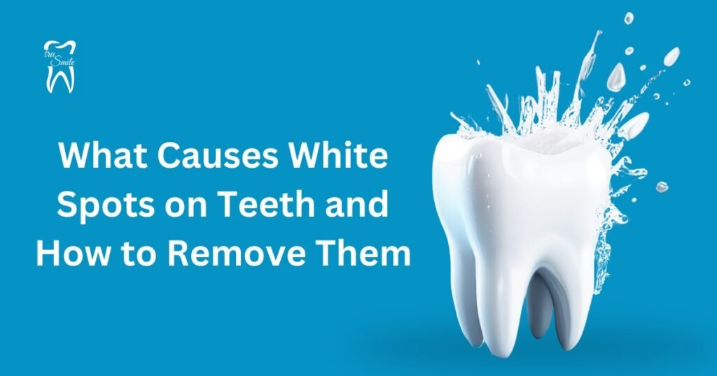 Image shows a large, white tooth with water splashing around it, set against a blue background. Text reads: 'What Causes White Spots on Teeth and How to Remove Them.