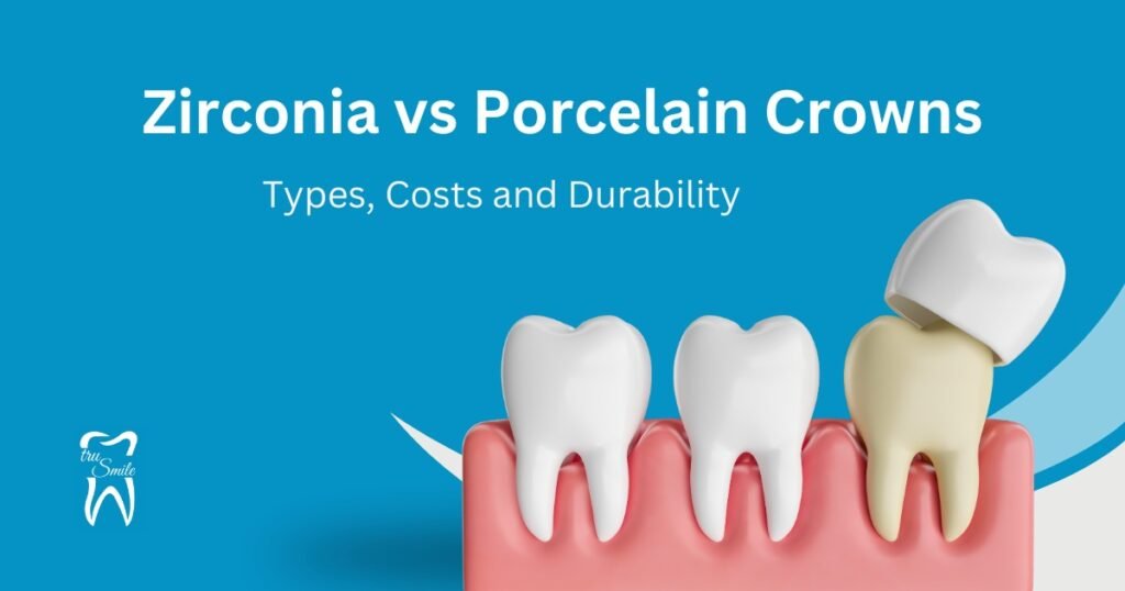 Image comparing Zirconia and Porcelain Crowns. Shows three teeth: one with a crown being placed. Title reads "Comparison of Zirconia vs Porcelain Crowns: Types, Costs, and Durability.